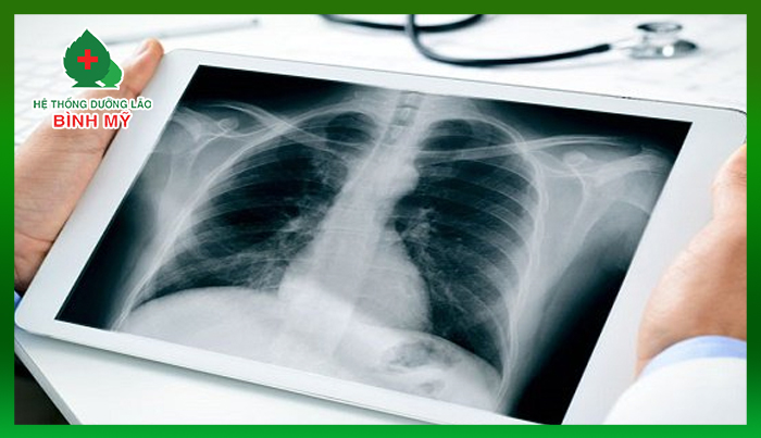 Chụp X-quang và chụp CT