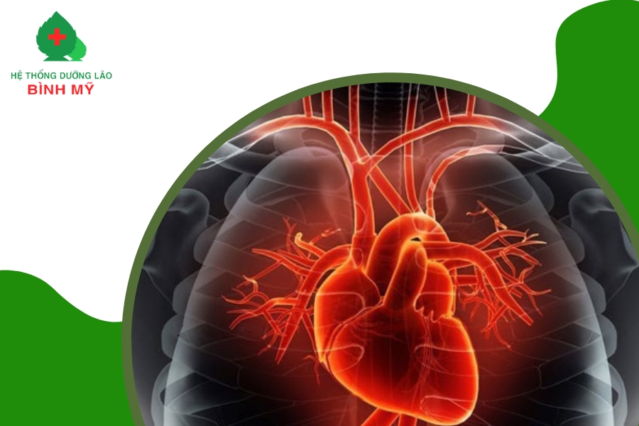 Nguyên nhân và cách điều trị nhồi máu cơ tim ở người già