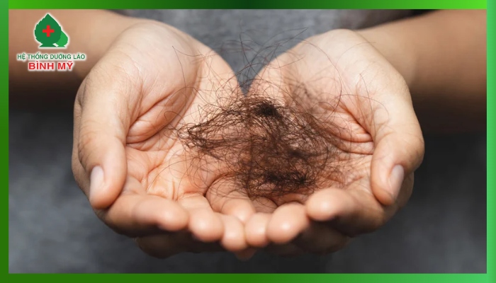 Rụng tóc nhiều là bệnh gì?