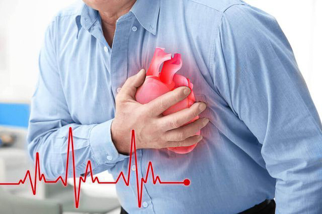 Những người mắc các bệnh tim mạch thường có nguy cơ cao gặp phải nhồi máu cơ tim và đột quỵ