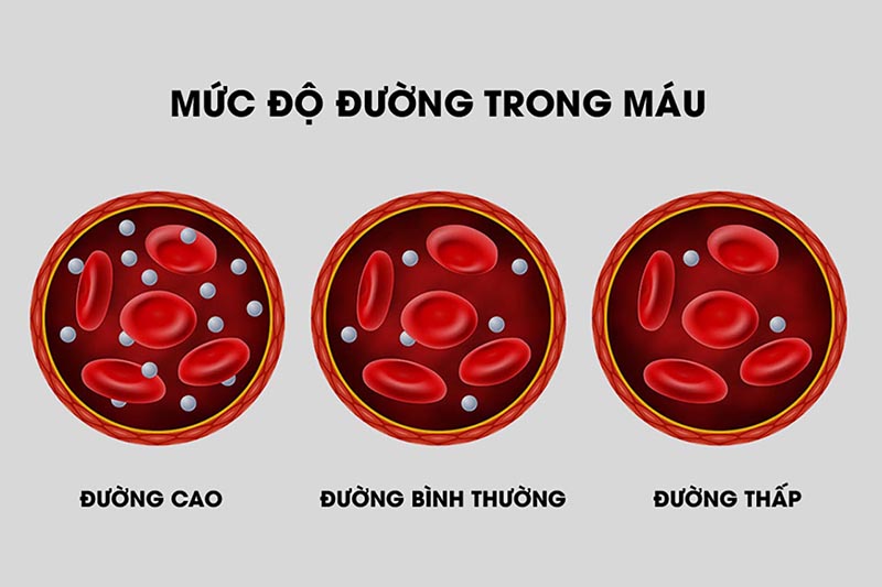 Mức độ đường trong máu