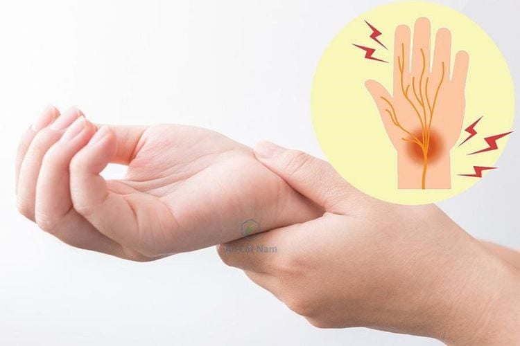 Người có dấu hiệu đột quỵ cảm giác tay bị tê yếu, mất khả năng cầm nắm